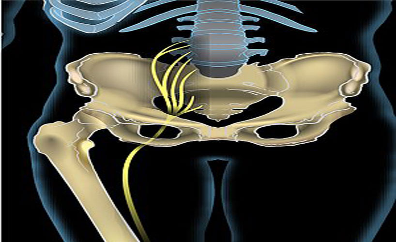 Fistula Treatment